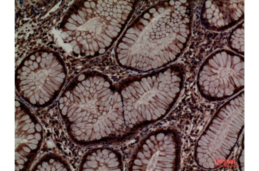 Immunohistochemistry - Anti-PDIA3 Antibody (C30255) - Antibodies.com