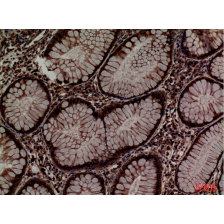 Immunohistochemistry - Anti-PDIA3 Antibody (C30255) - Antibodies.com