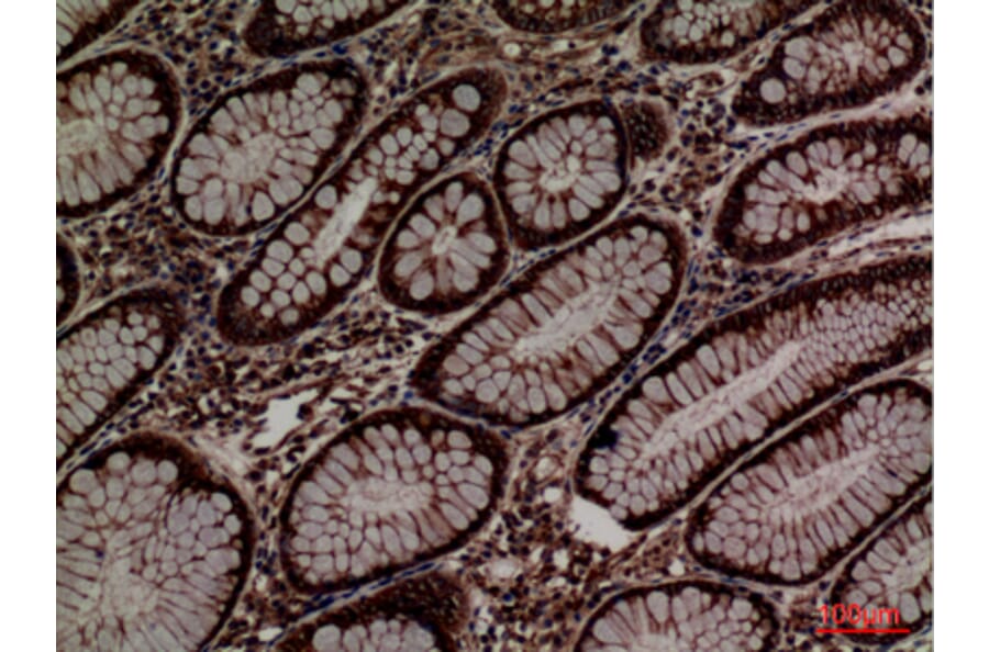 Immunohistochemistry - Anti-PDIA3 Antibody (C30255) - Antibodies.com