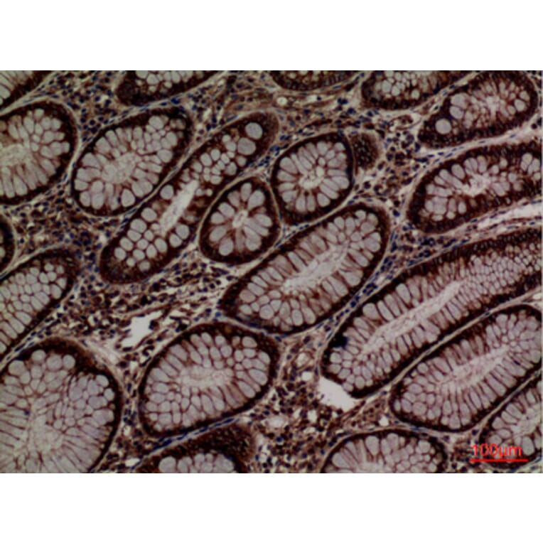 Immunohistochemistry - Anti-PDIA3 Antibody (C30255) - Antibodies.com