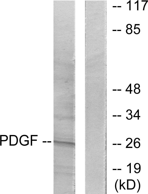 Western blot analysis of lysates from NIH/3T3 cells using Anti-PDGFB Antibody. The right hand lane represents a negative control, where the antibody is blocked by the immunising peptide.