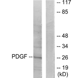 Western Blot - Anti-PDGFB Antibody (C0299) - Antibodies.com