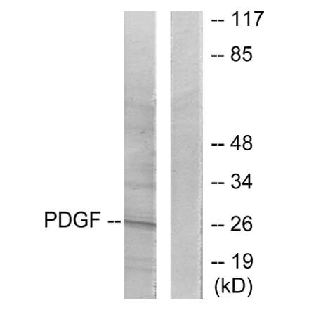 Western Blot - Anti-PDGFB Antibody (C0299) - Antibodies.com