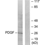 Western Blot - Anti-PDGFB Antibody (C0299) - Antibodies.com