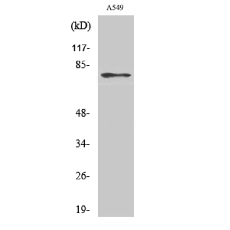 Western Blot - Anti-PDE4C Antibody (C14903) - Antibodies.com