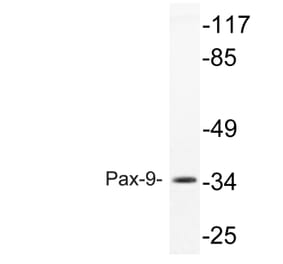 Western Blot - Anti-Pax-9 Antibody (R12-2295) - Antibodies.com