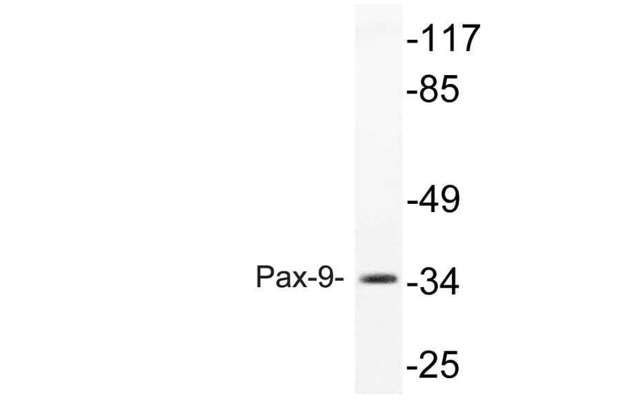 Western Blot - Anti-Pax-9 Antibody (R12-2295) - Antibodies.com