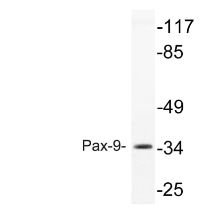 Western Blot - Anti-Pax-9 Antibody (R12-2295) - Antibodies.com