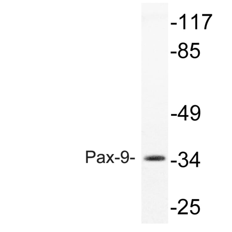 Western Blot - Anti-Pax-9 Antibody (R12-2295) - Antibodies.com