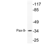 Western Blot - Anti-Pax-9 Antibody (R12-2295) - Antibodies.com