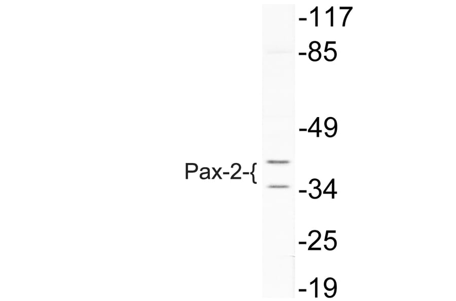 Western Blot - Anti-Pax-2 Antibody (R12-2293) - Antibodies.com