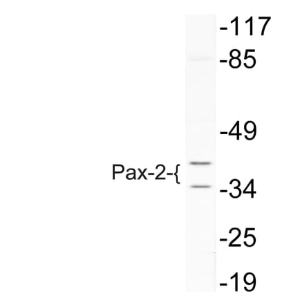 Western Blot - Anti-Pax-2 Antibody (R12-2293) - Antibodies.com