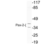 Western Blot - Anti-Pax-2 Antibody (R12-2293) - Antibodies.com