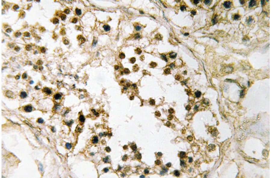 Immunohistochemistry - Anti-Pax-2 Antibody (R12-2293) - Antibodies.com