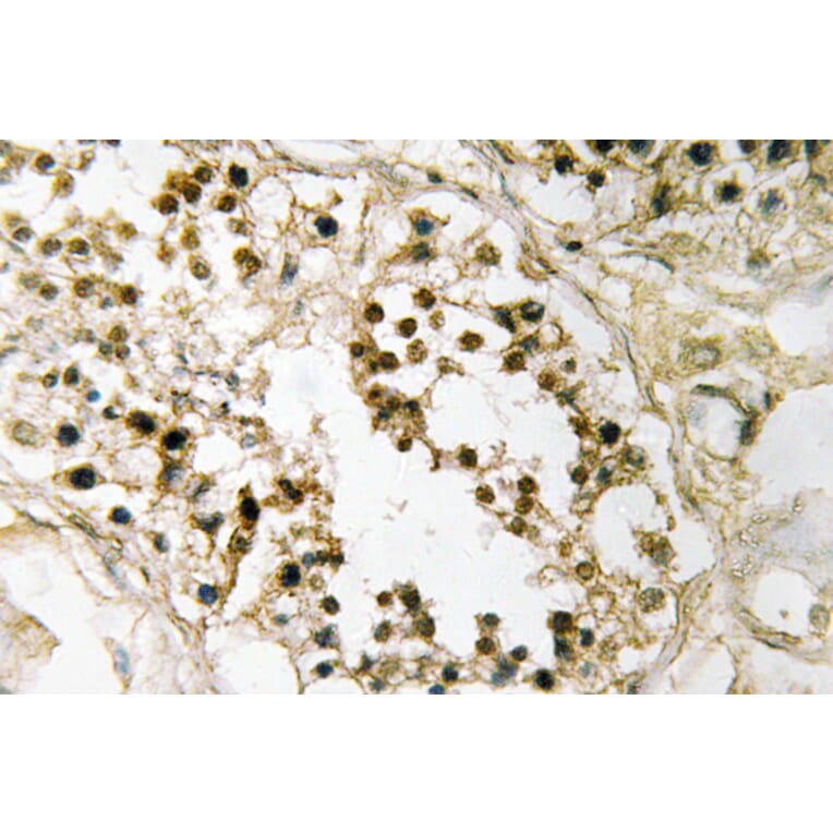 Immunohistochemistry - Anti-Pax-2 Antibody (R12-2293) - Antibodies.com