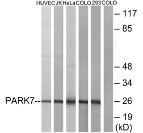 Western Blot - Anti-PARK7 Antibody (C13096) - Antibodies.com