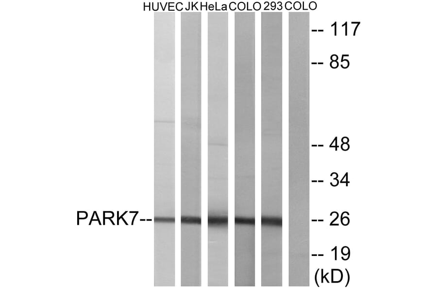 Western Blot - Anti-PARK7 Antibody (C13096) - Antibodies.com