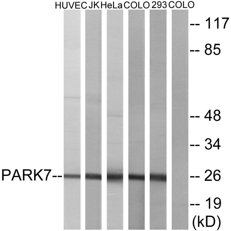 Western Blot - Anti-PARK7 Antibody (C13096) - Antibodies.com