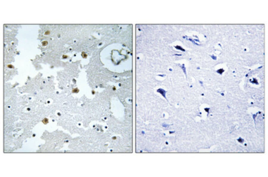 Immunohistochemistry - Anti-PARK7 Antibody (C13096) - Antibodies.com