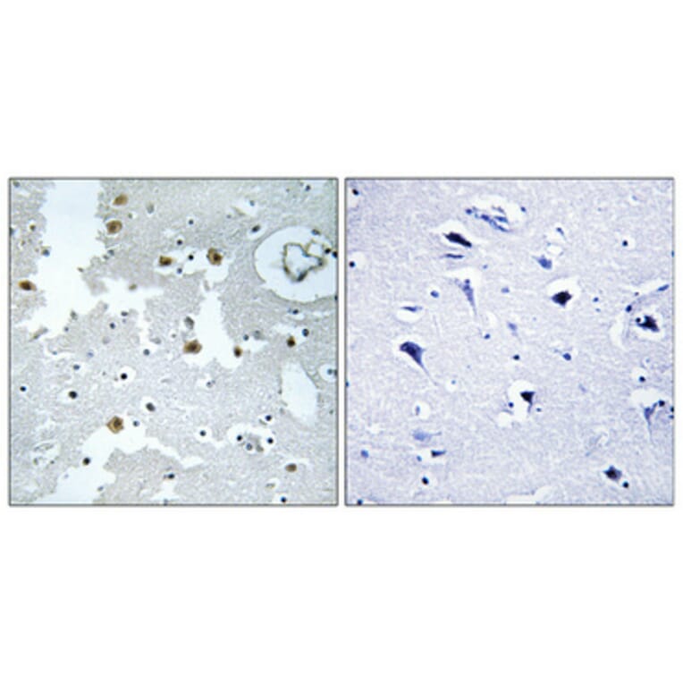 Immunohistochemistry - Anti-PARK7 Antibody (C13096) - Antibodies.com