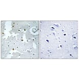 Immunohistochemistry - Anti-PARK7 Antibody (C13096) - Antibodies.com