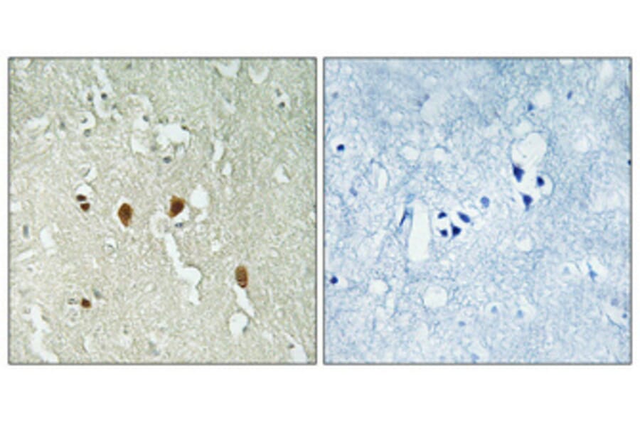 Immunohistochemistry - Anti-PARK7 Antibody (C13096) - Antibodies.com