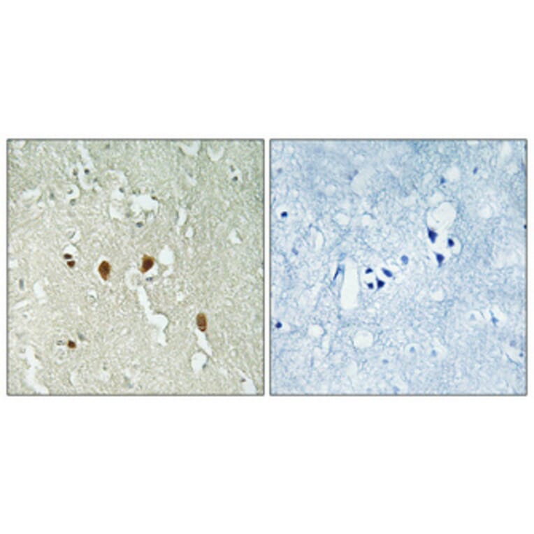 Immunohistochemistry - Anti-PARK7 Antibody (C13096) - Antibodies.com