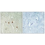 Immunohistochemistry - Anti-PARK7 Antibody (C13096) - Antibodies.com