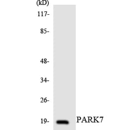 Western Blot - Anti-PARK7 Antibody (R12-3302) - Antibodies.com