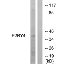 Western Blot - Anti-P2RY4 Antibody (G708) - Antibodies.com