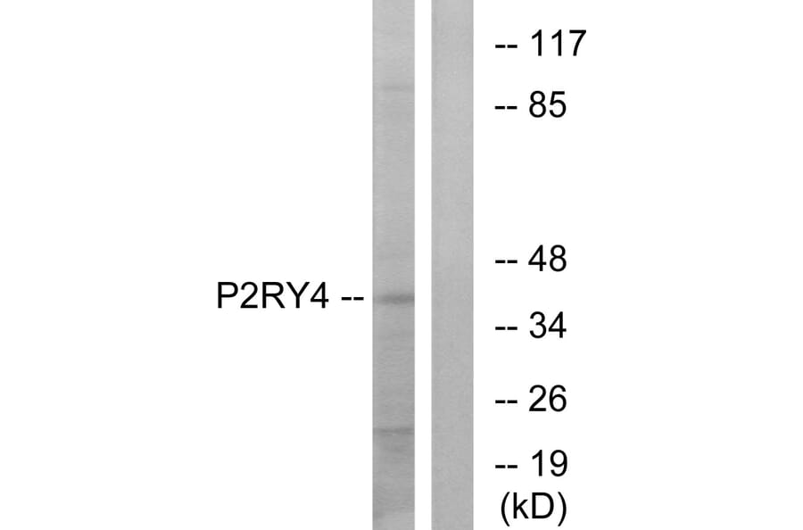 Western Blot - Anti-P2RY4 Antibody (G708) - Antibodies.com