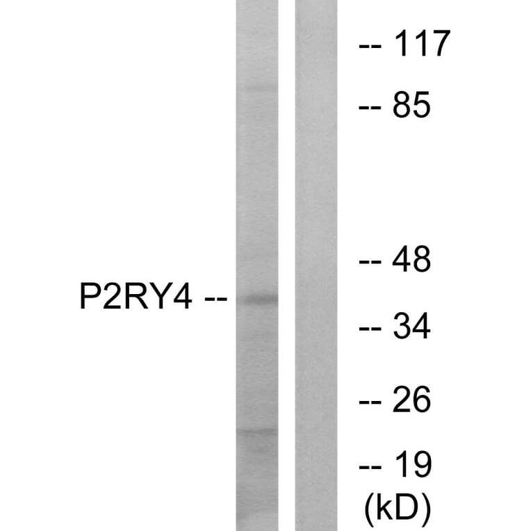 Western Blot - Anti-P2RY4 Antibody (G708) - Antibodies.com