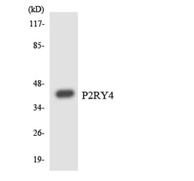 Western Blot - Anti-P2RY4 Antibody (R12-3281) - Antibodies.com