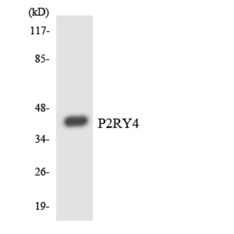 Western Blot - Anti-P2RY4 Antibody (R12-3281) - Antibodies.com