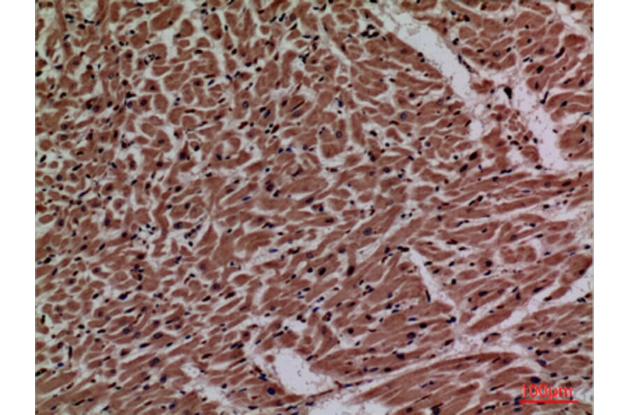 Immunohistochemistry - Anti-P2RX3 Antibody (C30189) - Antibodies.com