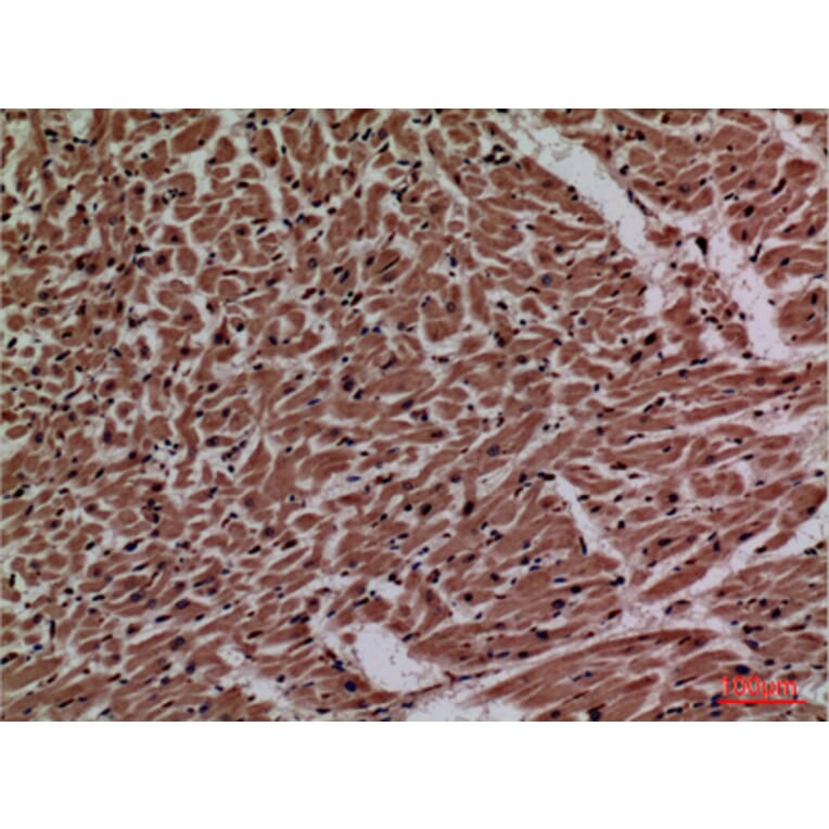 Immunohistochemistry - Anti-P2RX3 Antibody (C30189) - Antibodies.com