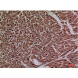 Immunohistochemistry - Anti-P2RX3 Antibody (C30189) - Antibodies.com