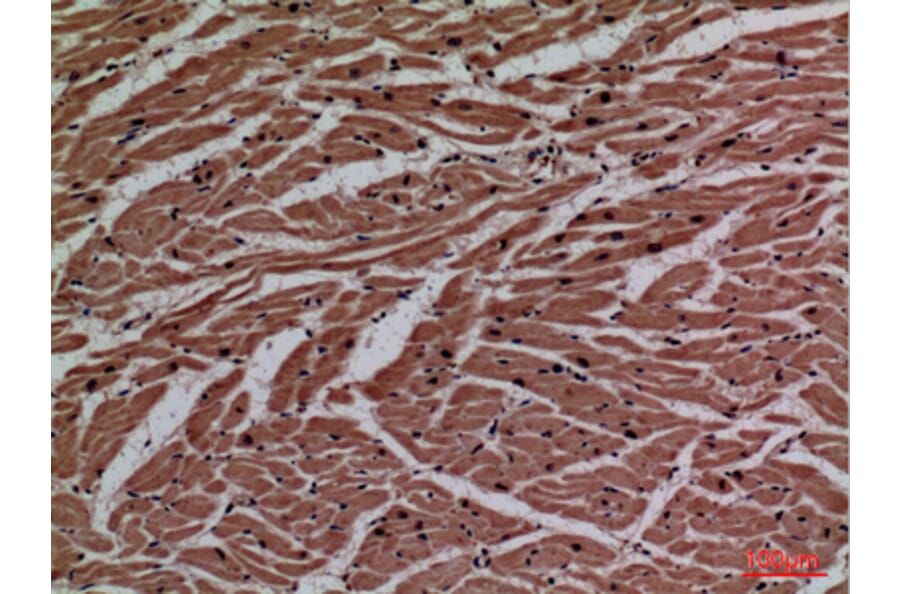 Immunohistochemistry - Anti-P2RX3 Antibody (C30189) - Antibodies.com