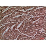 Immunohistochemistry - Anti-P2RX3 Antibody (C30189) - Antibodies.com