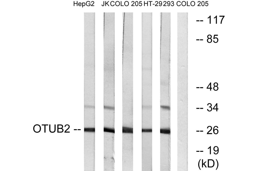 Western Blot - Anti-OTUB2 Antibody (C19413) - Antibodies.com