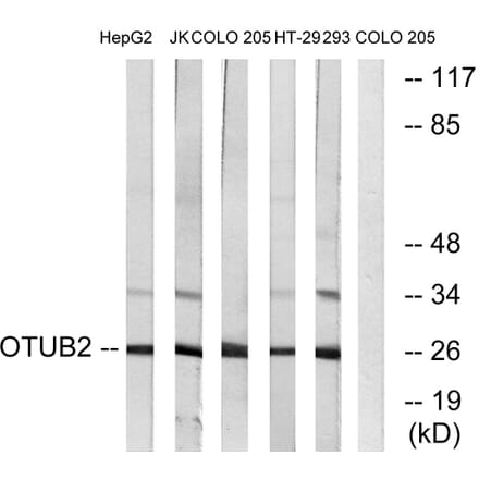Western Blot - Anti-OTUB2 Antibody (C19413) - Antibodies.com