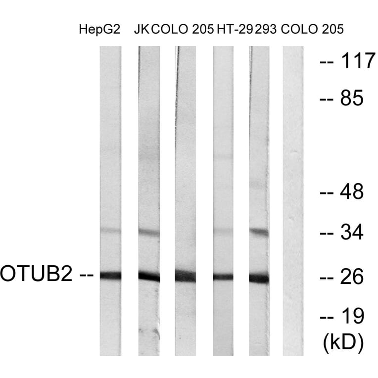 Western Blot - Anti-OTUB2 Antibody (C19413) - Antibodies.com