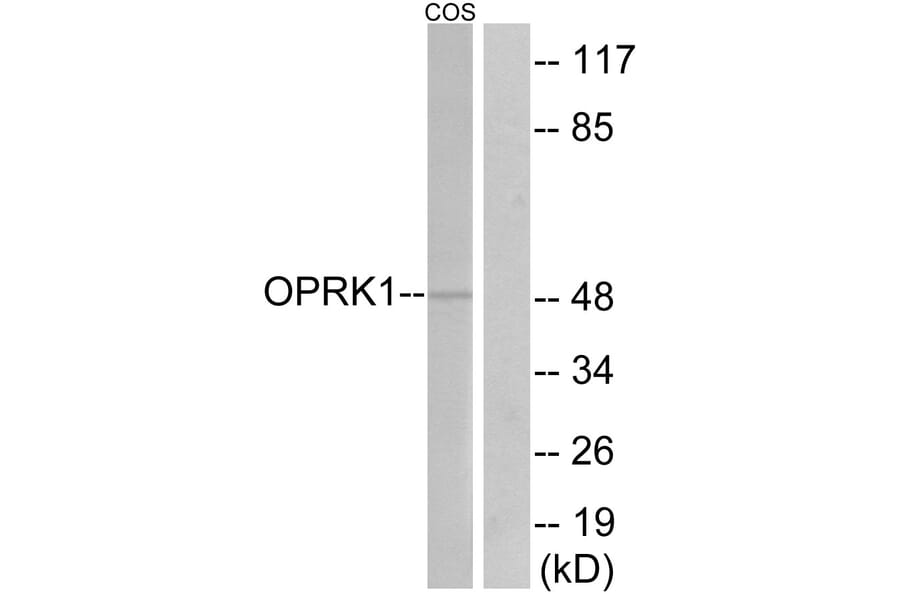 Western Blot - Anti-OPRK1 Antibody (G491) - Antibodies.com