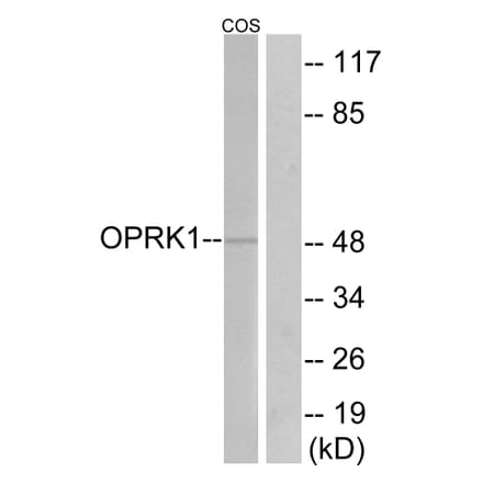 Western Blot - Anti-OPRK1 Antibody (G491) - Antibodies.com