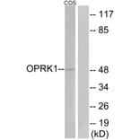 Western Blot - Anti-OPRK1 Antibody (G491) - Antibodies.com