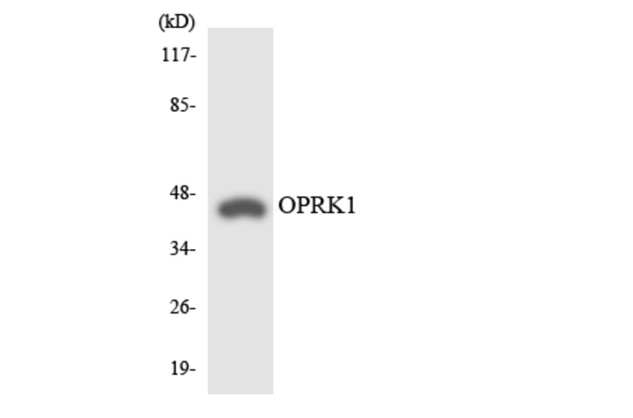 Western Blot - Anti-OPRK1 Antibody (R12-3123) - Antibodies.com