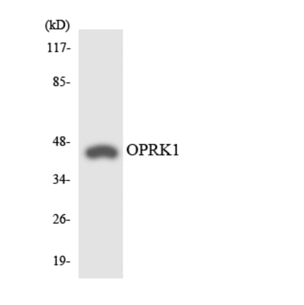 Western Blot - Anti-OPRK1 Antibody (R12-3123) - Antibodies.com