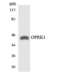 Western Blot - Anti-OPRK1 Antibody (R12-3123) - Antibodies.com