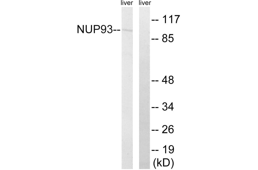 Western Blot - Anti-NUP93 Antibody (C17097) - Antibodies.com