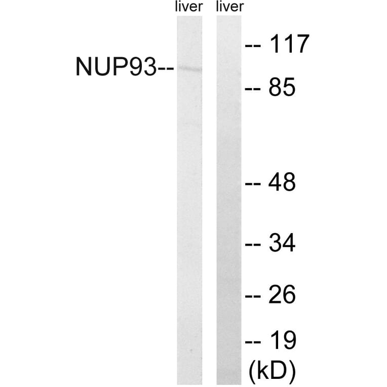Western Blot - Anti-NUP93 Antibody (C17097) - Antibodies.com